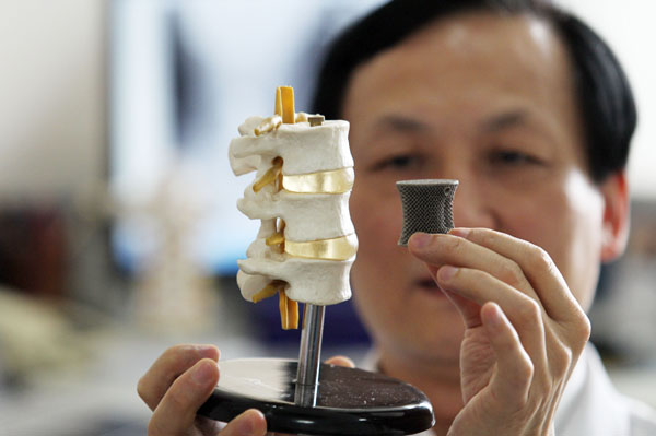A 3-D printed medical implant is shown at Peking University Third Hospital in Beijing, Aug 6, 2013. Dozens of such implants have been used in more than 50 patients, said Liu Zhongjun, director of the Orthopedic Department of the hospital. Hospital uses 3D printed orthopedic implants