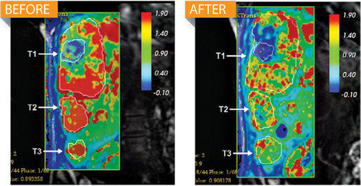 喚醒人體沉睡防御系統(tǒng) 美找到癌癥克星并有望包治百病