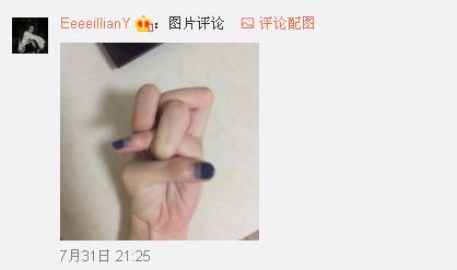 一般人做不出的張一山秋水誓？醫(yī)生：這是??！